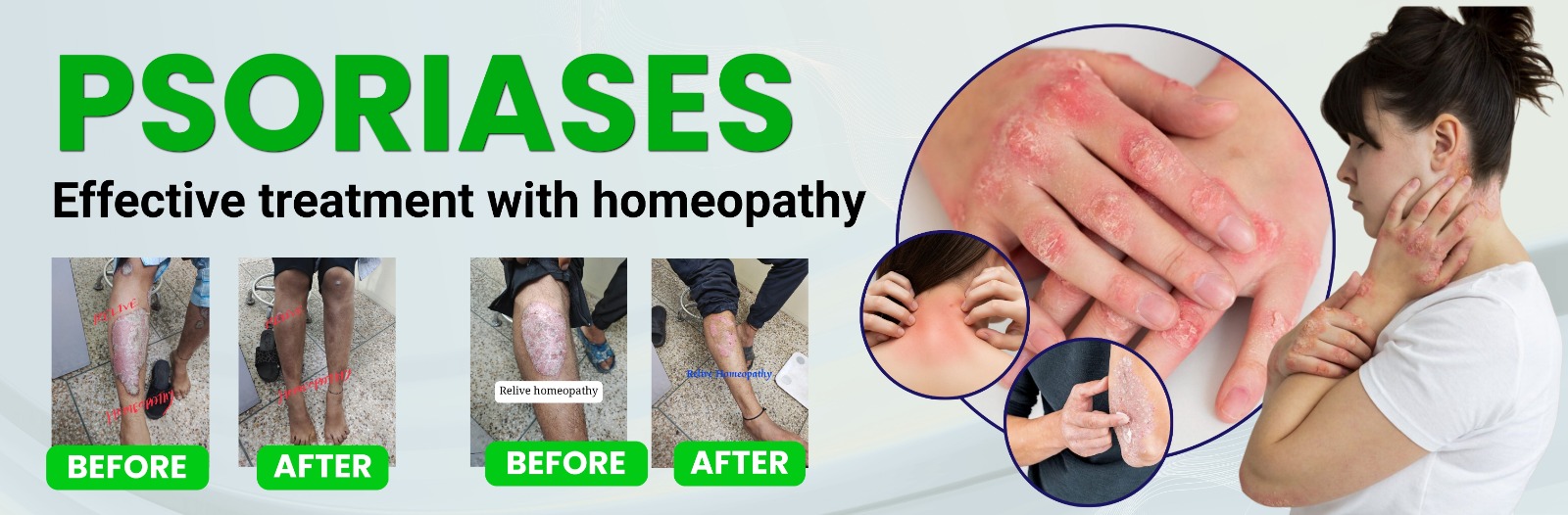 Relive Homeopathy Banner 2