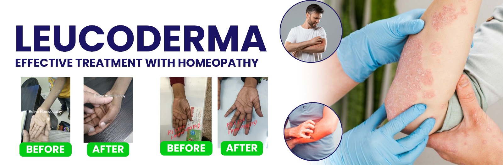 Relive Homeopathy Banner 4
